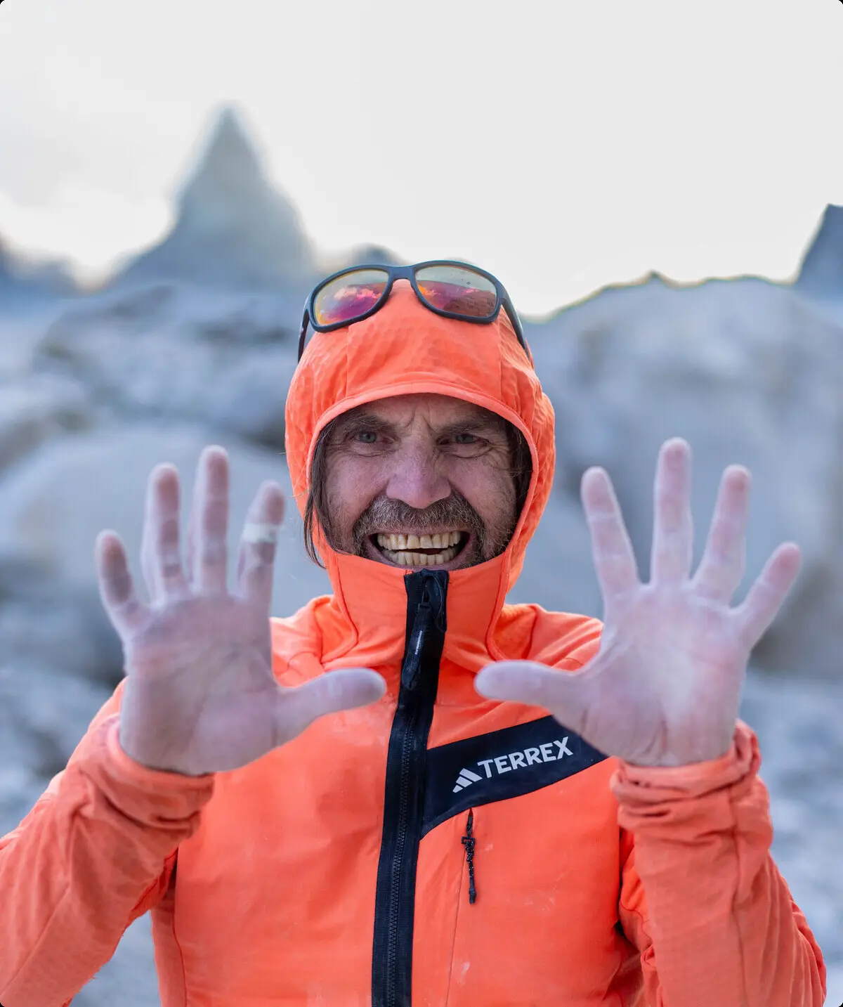 Kletterer zeigt seine Hände | © Thomas Huber